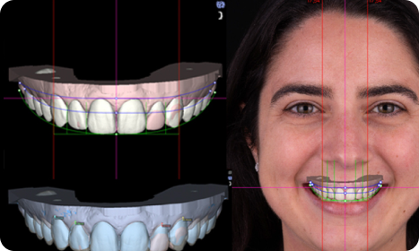 Digital Smile Design Coimbatore
