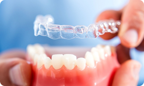 Working of Aligners